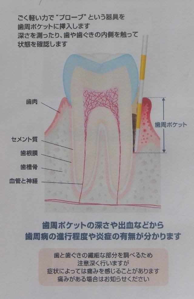 歯周病の発症
